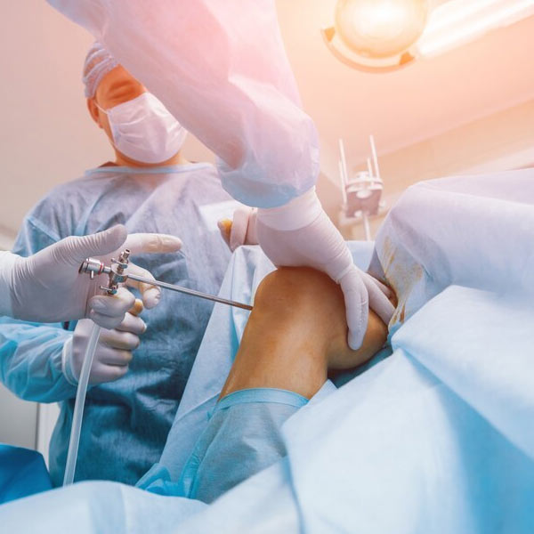 Arthroscopy in Vijayawada