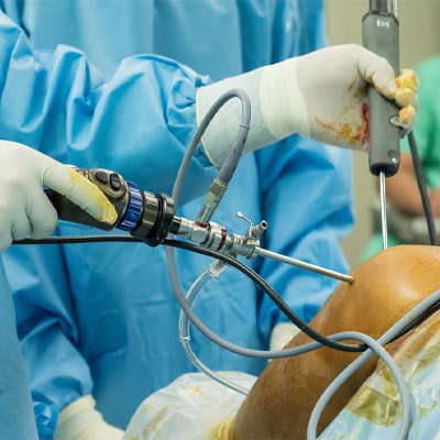 Joint Reconstruction Surgery in Vijayawada