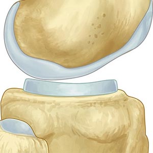 Cartilage Culture in Vijayawada