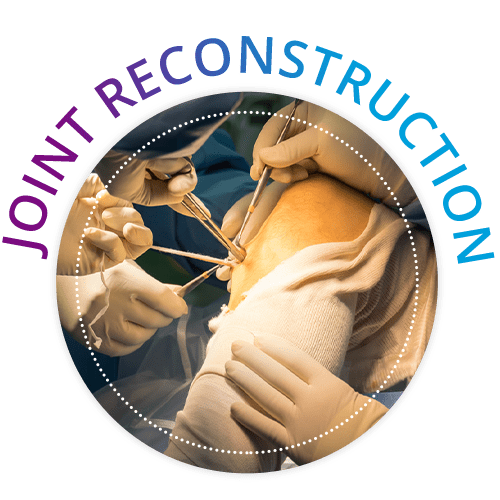 joint reconstruction in vijayawada