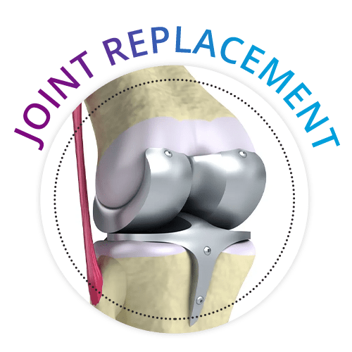 joint replacement hospital in Vijayawada